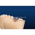 Customized Full Metal Dental Crown
